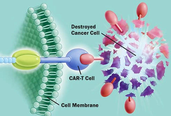 Gene Therapy