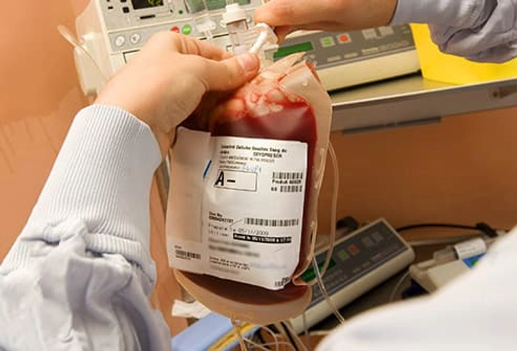Stem Cell Transplant Stem Cell Transplant