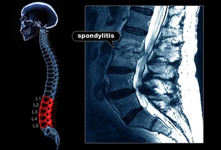 Back and Heel Pain
