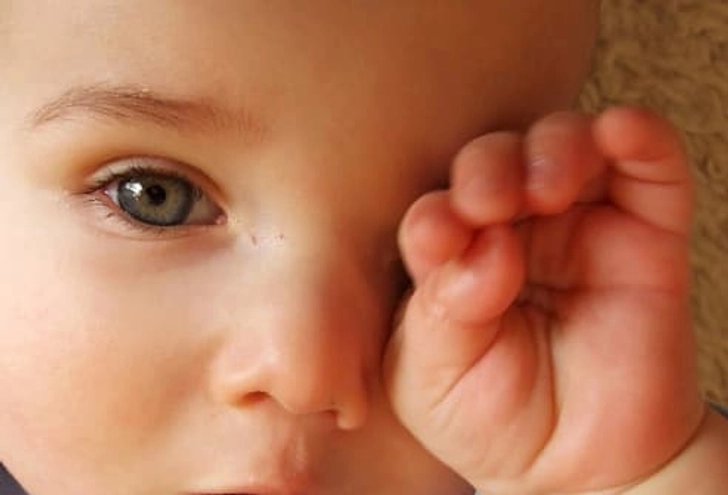 What Causes a Stye? What Causes a Stye?