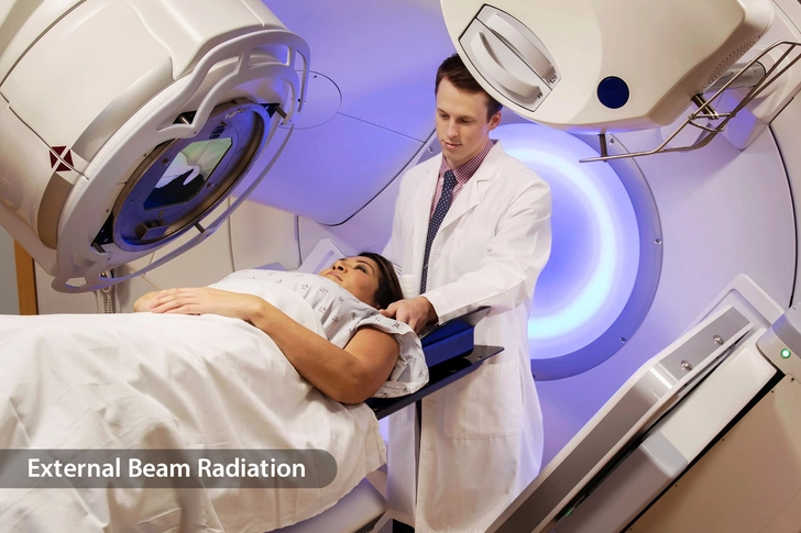 Radiation Therapy