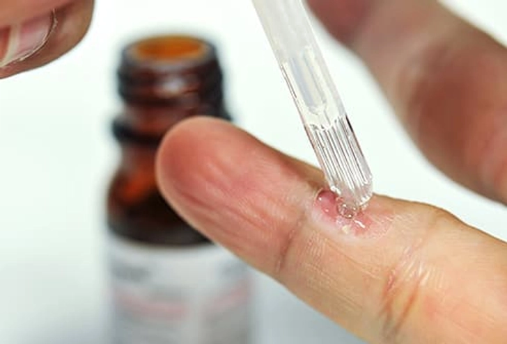 Peeling Products