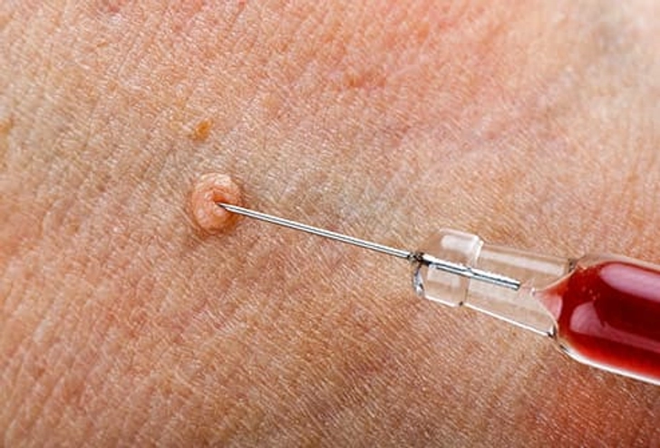 Injections Injections