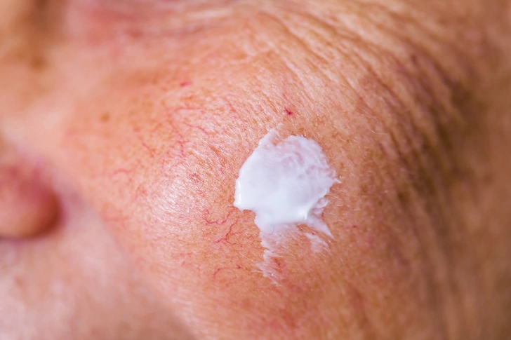 Treatment Treatment