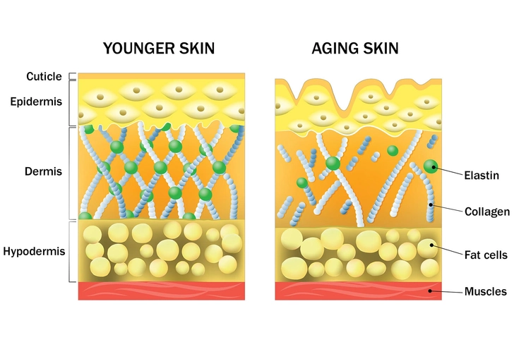 Cause: Age