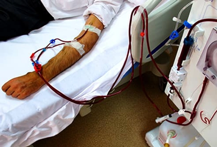 Too Much Potassium (Hyperkalemia)