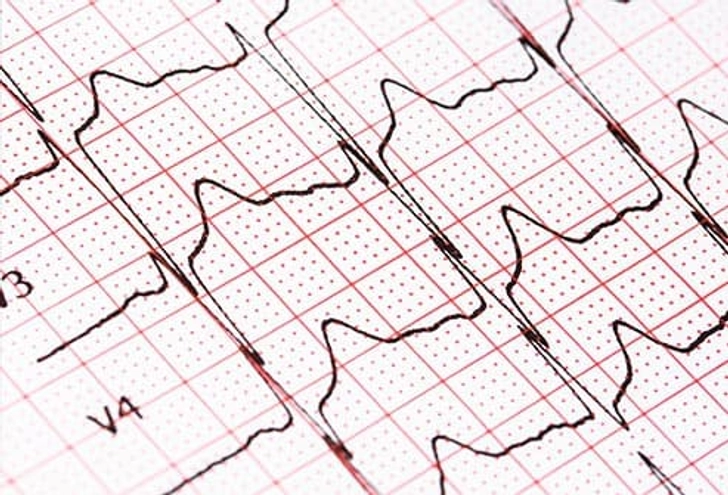 Pay Attention to Your Heartbeat