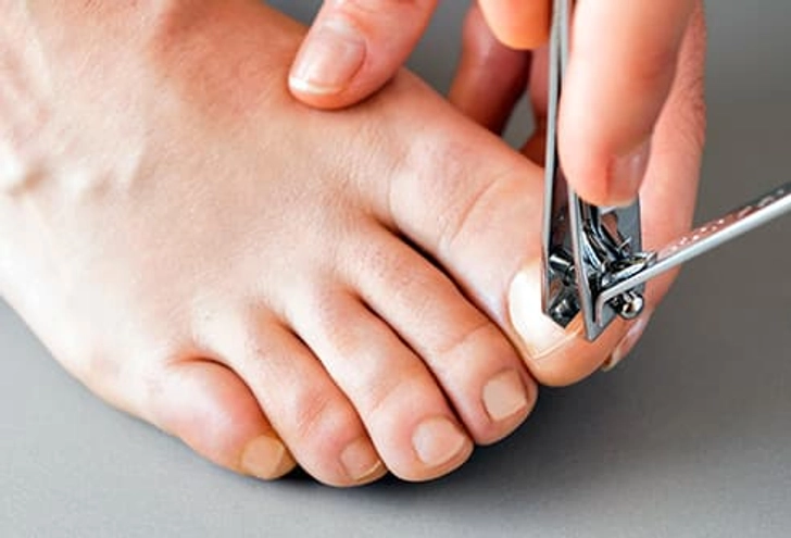 Trim Your Toenails