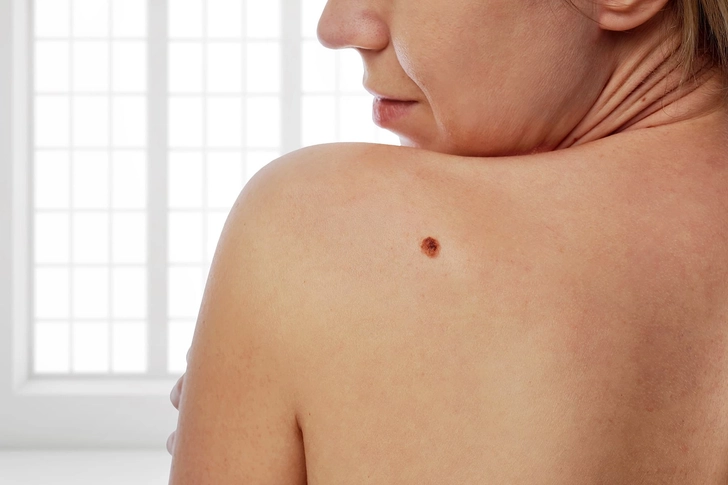 Check Your Skin