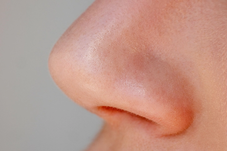 Nose Hair Loss
