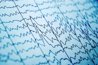 Seizures