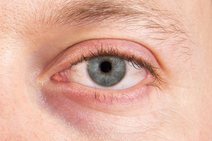 Dries Out Eyes Dries Out Eyes