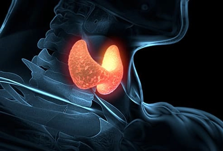 Overactive Thyroid Gland