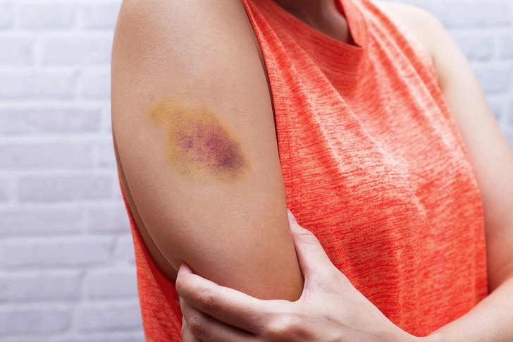 Less-Common Side Effects Less-Common Side Effects