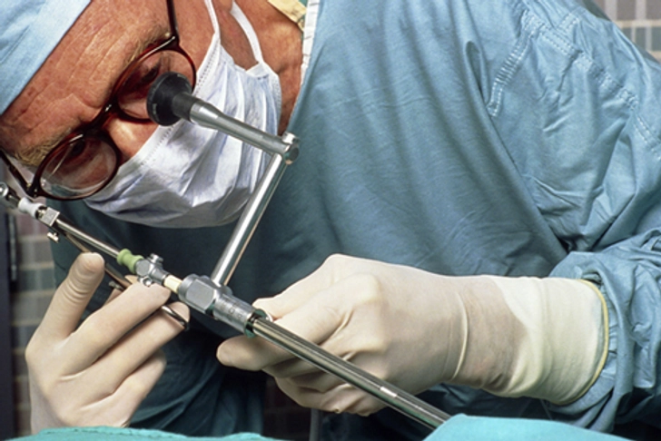Laparoscopic Radiofrequency Ablation 