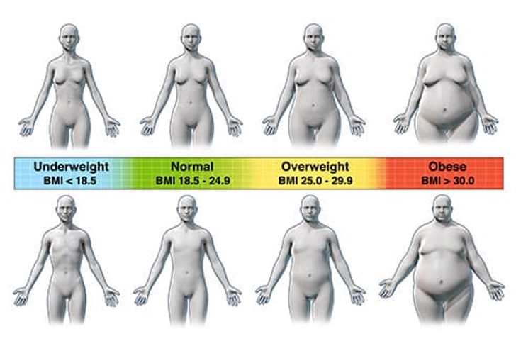 Body Mass Index (BMI)