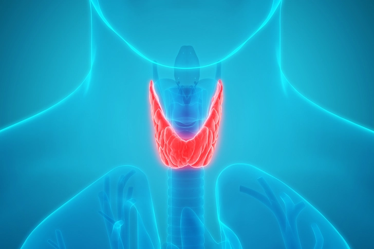 Cause: Low Thyroid Levels