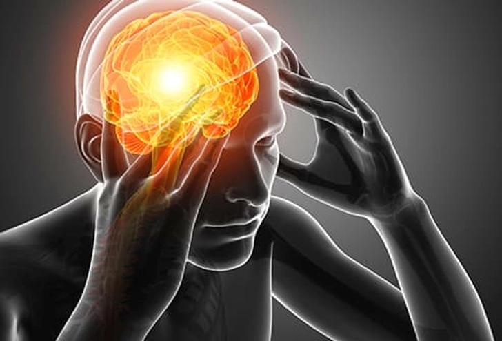 Migraine and Cluster Headaches
