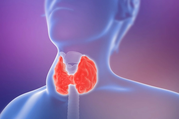 Overactive Thyroid