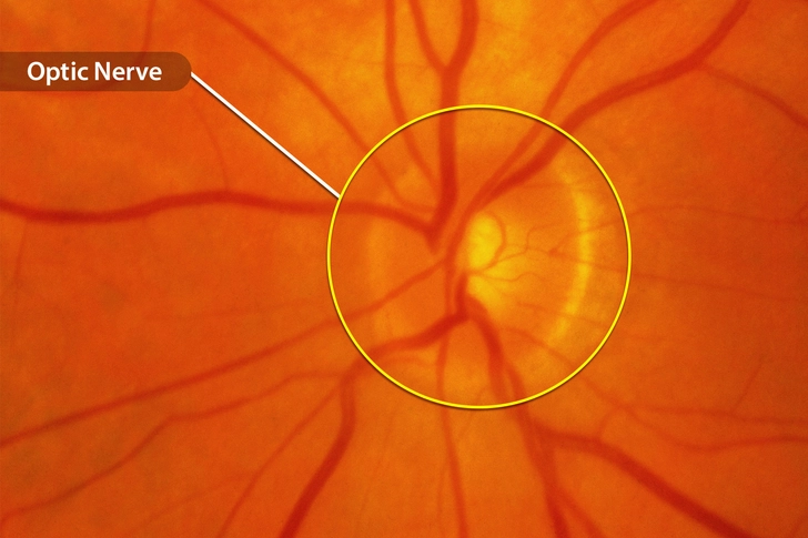 Retina Exam
