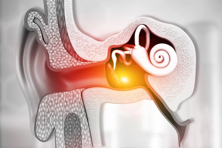 What Causes It?