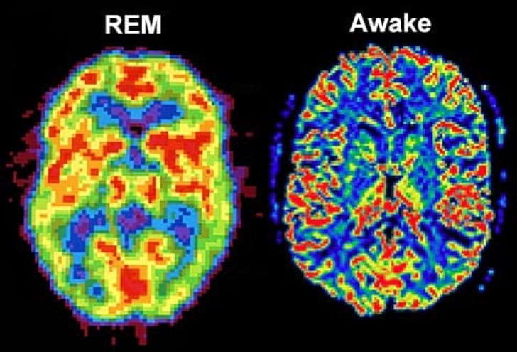 Brain Activity Brain Activity