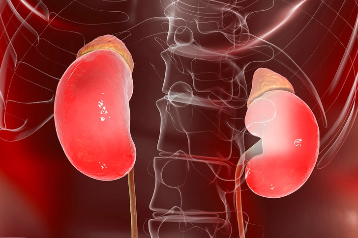 Kidney Problems Can Worsen