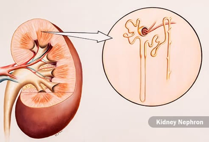 Kidney Failure Kidney Failure