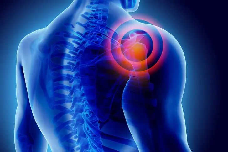 What’s Frozen Shoulder? What’s Frozen Shoulder?