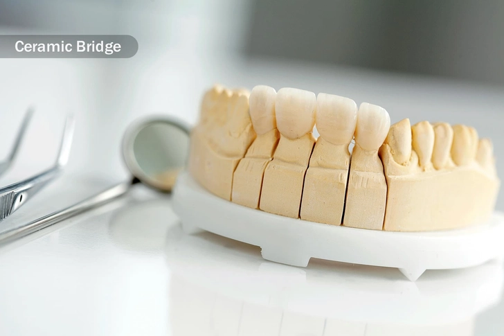 Dental Work Dental Work