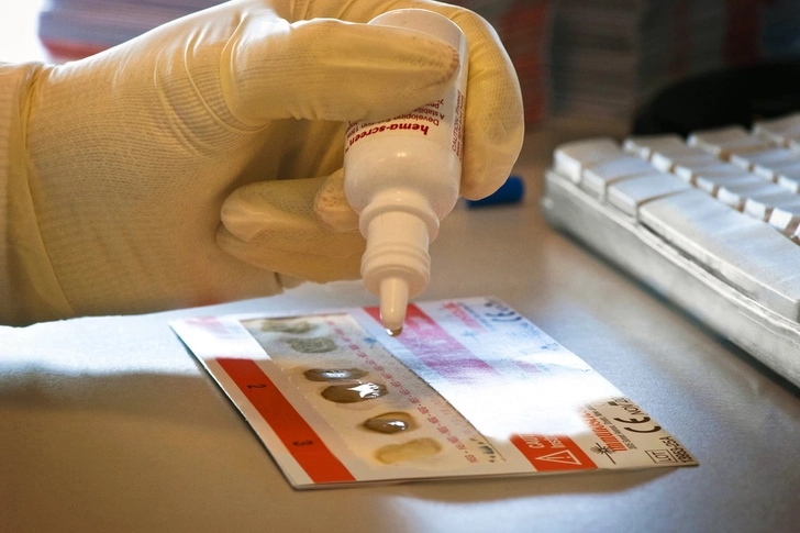 Pros and Cons of Stool Tests