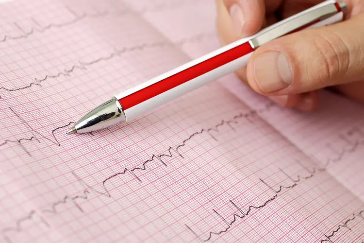 photo of arrhythmia readout