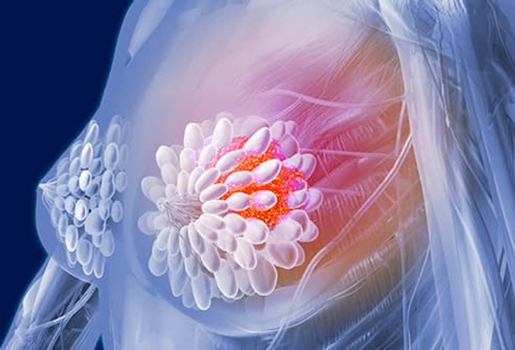 Who Shouldn’t Use HRT?