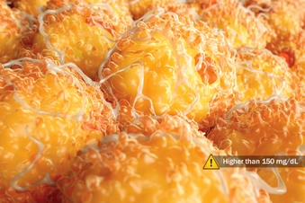 High Triglycerides