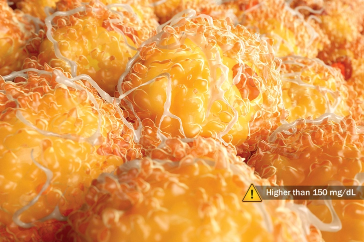 High Triglycerides