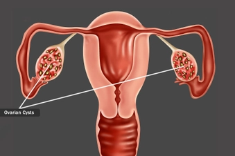 Other Possible Causes