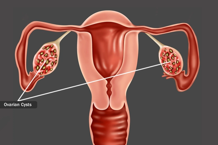 Other Possible Causes