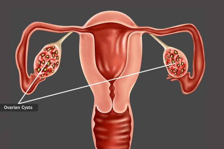 Other Possible Causes Other Possible Causes