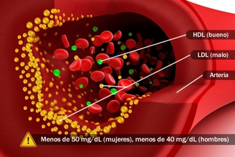 Colesterol HDL demasiado bajo