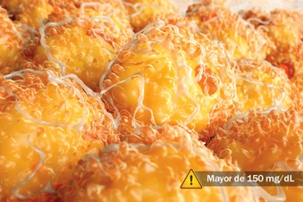Triglicéridos altos Triglicéridos altos