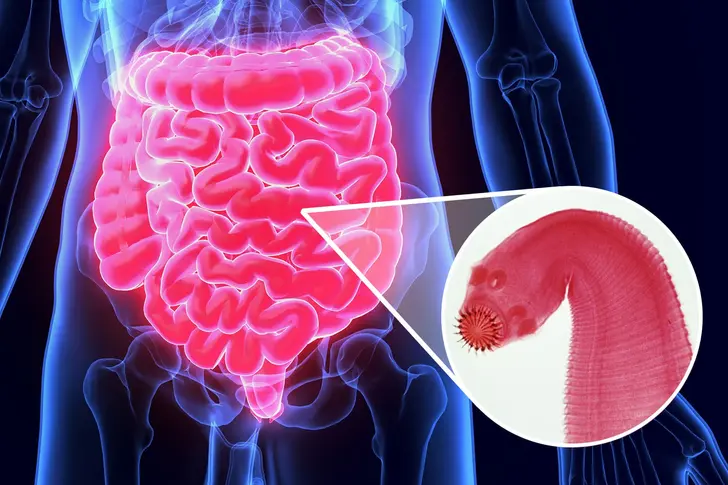 Gut Parasite Gut Parasite