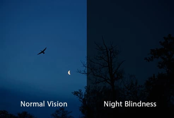 Night Blindness