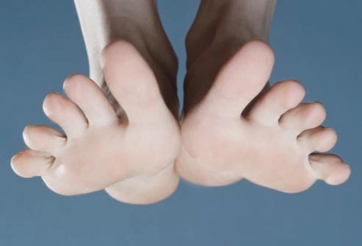 Foot Spasms Foot Spasms