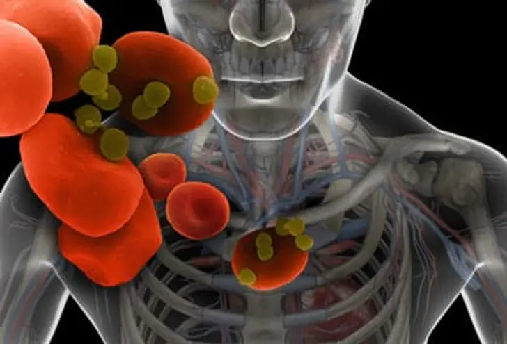 Can Mouth Bacteria Affect the Heart? Can Mouth Bacteria Affect the Heart?