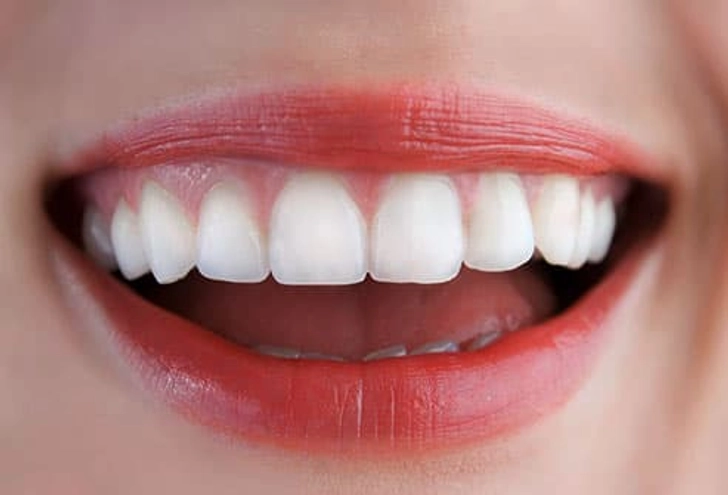What Healthy Gums Look Like What Healthy Gums Look Like