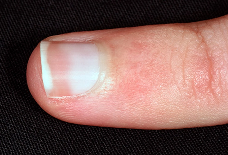 Pale Nails