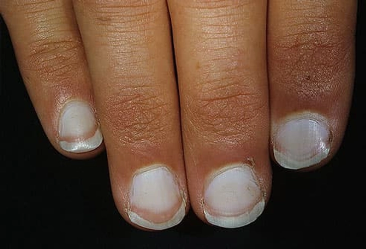 White Nails White Nails