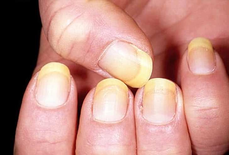 Yellow Nails Yellow Nails