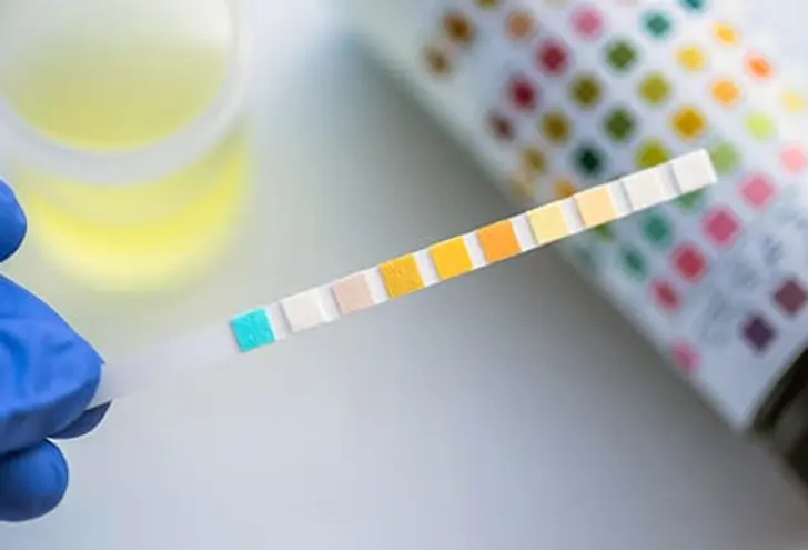 Your Urine and Your Health Your Urine and Your Health