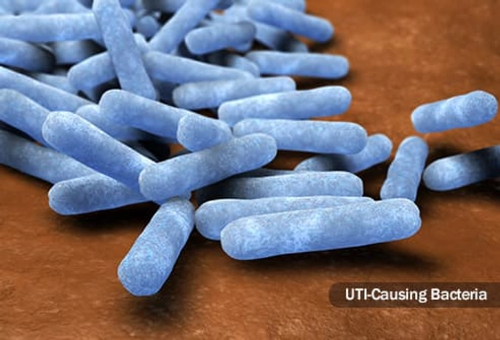 Urinary Tract Infection (UTI) Urinary Tract Infection (UTI)